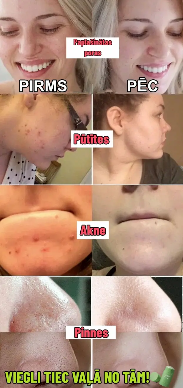 Dziļi attīroša sejas maska ar zaļās tējas ekstraktu Moisture.lv 5 Dziļi attīroša sejas maska ar zaļās tējas ekstraktu Moisture.lv 5