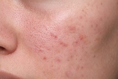 Moisture maskējošais daudzfunkcionālais CC krēms Moisture.lv 39